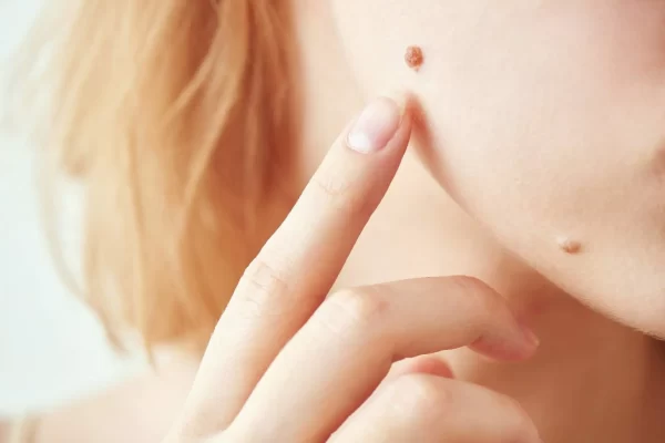 promo-banner-image